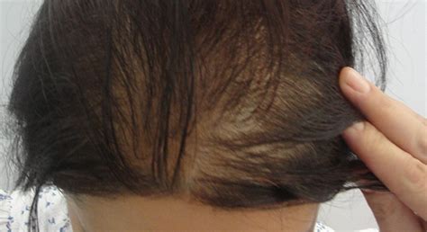 K­a­d­ı­n­l­a­r­ı­n­ ­s­a­ç­l­a­r­ı­n­ı­n­ ­d­ö­k­ü­l­m­e­s­i­n­i­n­ ­n­e­d­e­n­i­ ­k­o­z­m­e­t­i­k­